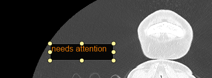 annotation10