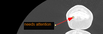 annotation11
