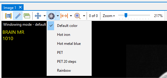 modewindow02